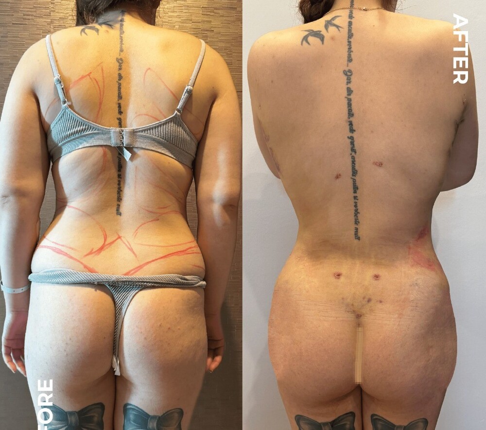 Before and After Result